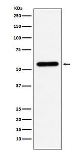 Anti-Liver Carboxylesterase 1 Monoclonal Antibody Boster Bio