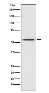 Anti-Protein C Rabbit Monoclonal Antibody Boster Bio