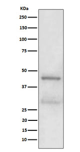Anti-MBD2 Rabbit Monoclonal Antibody Boster Bio