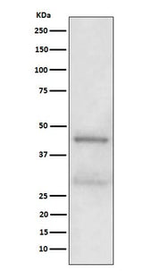Anti-MBD2 Rabbit Monoclonal Antibody Boster Bio