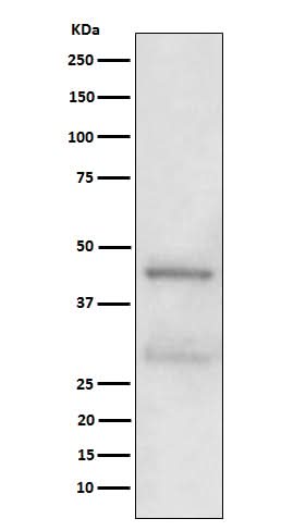 Anti-MBD2 Rabbit Monoclonal Antibody Boster Bio