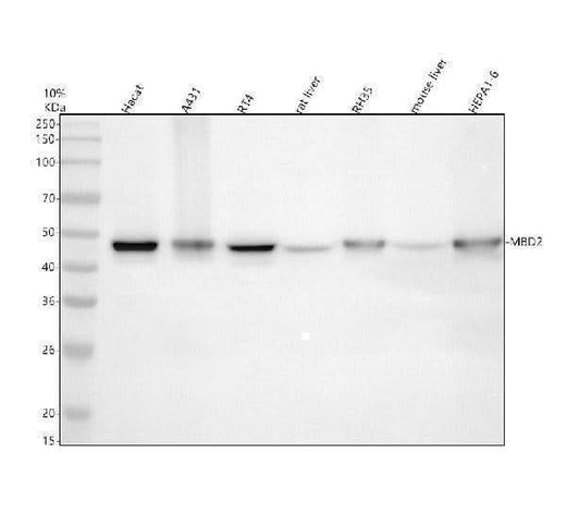 Anti-MBD2 Rabbit Monoclonal Antibody Boster Bio