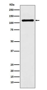 Anti-DPYD Rabbit Monoclonal Antibody Boster Bio