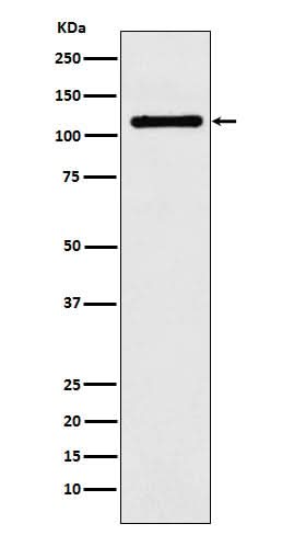 Anti-DPYD Rabbit Monoclonal Antibody Boster Bio