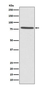 Anti-Ezrin Rabbit Monoclonal Antibody Boster Bio