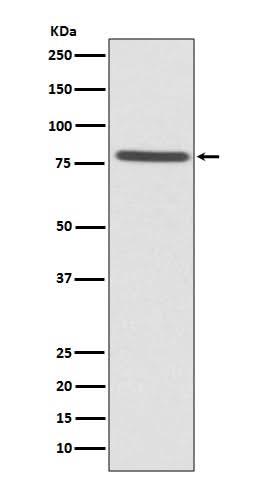 Anti-Ezrin Rabbit Monoclonal Antibody Boster Bio