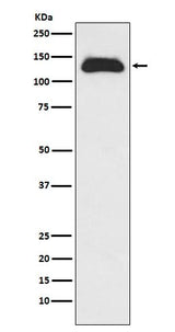 Anti-Eg5 Rabbit Monoclonal Antibody Boster Bio
