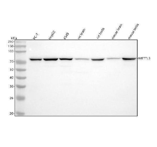 Anti-METTL3 Rabbit Monoclonal Antibody Boster Bio
