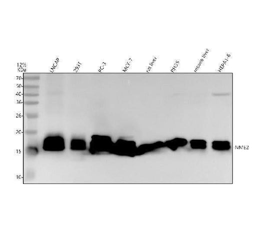 Anti-NME2 Rabbit Monoclonal Antibody Boster Bio