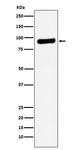 Anti-RRM1 Monoclonal Antibody Boster Bio