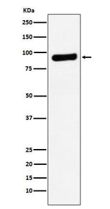 Anti-RRM1 Monoclonal Antibody Boster Bio