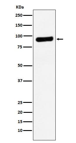 Anti-RRM1 Monoclonal Antibody Boster Bio