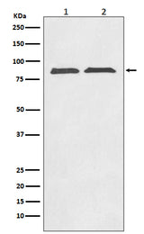 Anti-Axin2/Conductin Rabbit Monoclonal Antibody Boster Bio