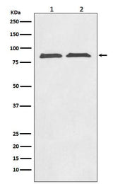 Anti-Axin2/Conductin Rabbit Monoclonal Antibody Boster Bio