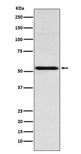 Anti-THRA Rabbit Monoclonal Antibody Boster Bio