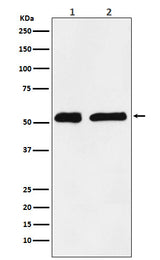 Anti-KPNA2 Monoclonal Antibody Boster Bio