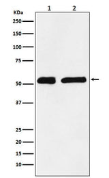 Anti-KPNA2 Monoclonal Antibody Boster Bio