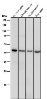 Anti-CD83 Rabbit Monoclonal Antibody Boster Bio