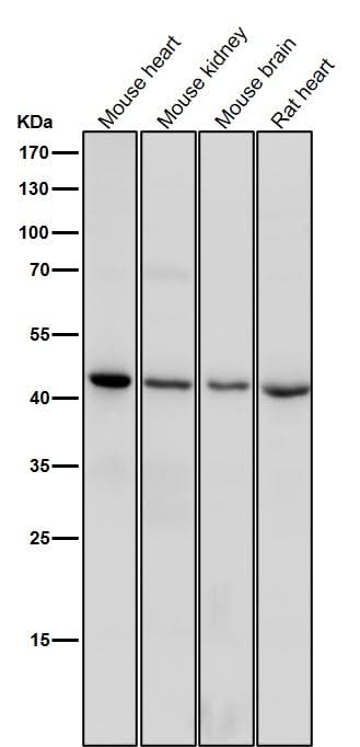 Anti-CD83 Rabbit Monoclonal Antibody Boster Bio