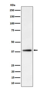 Anti-FDPS Rabbit Monoclonal Antibody Boster Bio