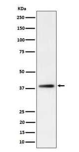 Anti-FDPS Rabbit Monoclonal Antibody Boster Bio