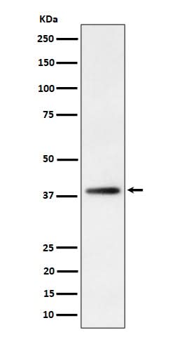 Anti-FDPS Rabbit Monoclonal Antibody Boster Bio