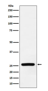 Anti-Superoxide Dismutase 3 Rabbit Monoclonal Antibody Boster Bio