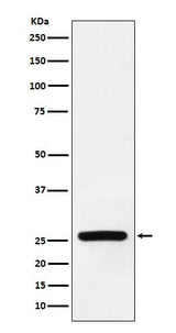 Anti-Superoxide Dismutase 3 Rabbit Monoclonal Antibody Boster Bio