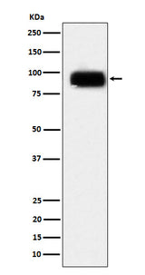 Anti-CD166 Monoclonal Antibody Boster Bio