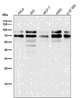 Anti-TFE3 Monoclonal Antibody Boster Bio