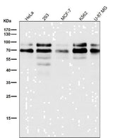 Anti-TFE3 Monoclonal Antibody Boster Bio