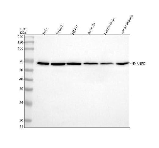 Anti-hnRNP K Rabbit Monoclonal Antibody Boster Bio