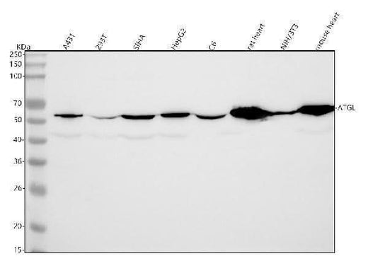 Anti-ATGL / PNPLA2 Rabbit Monoclonal Antibody Boster Bio