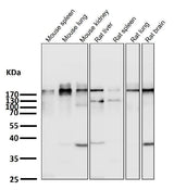Anti-Acetyl-CoA Carboxylase Monoclonal Antibody Boster Bio
