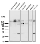 Anti-Acetyl-CoA Carboxylase Monoclonal Antibody Boster Bio