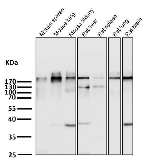 Anti-Acetyl-CoA Carboxylase Monoclonal Antibody Boster Bio