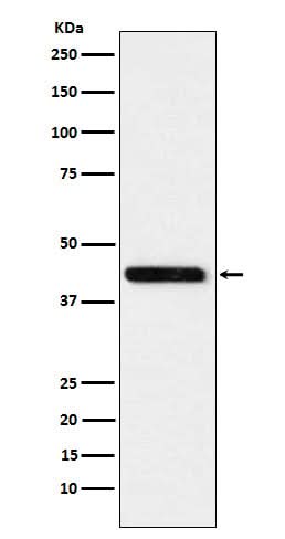 Anti-Cystathionase Rabbit Monoclonal Antibody Boster Bio