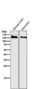 Anti-NMDAR1 GRIN1 Rabbit Monoclonal Antibody Boster Bio