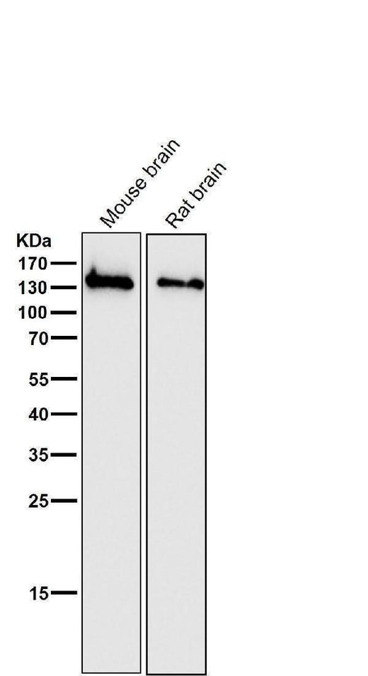 Anti-NMDAR1 GRIN1 Rabbit Monoclonal Antibody Boster Bio