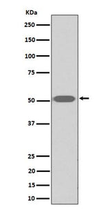 Anti-Thromboxane A2 receptor Rabbit Monoclonal Antibody Boster Bio