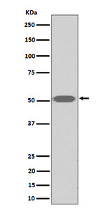 Anti-Thromboxane A2 receptor Rabbit Monoclonal Antibody Boster Bio