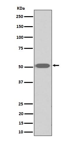 Anti-Thromboxane A2 receptor Rabbit Monoclonal Antibody Boster Bio