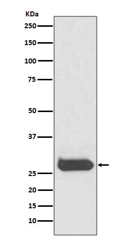 Anti-THY1/Cd90 Rabbit Monoclonal Antibody Boster Bio