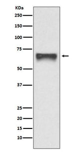 Anti-FoxO4/Afx Rabbit Monoclonal Antibody Boster Bio