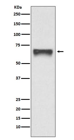 Anti-FoxO4/Afx Rabbit Monoclonal Antibody Boster Bio