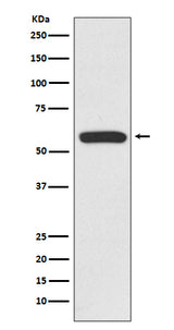 Anti-IRF6 Rabbit Monoclonal Antibody Boster Bio