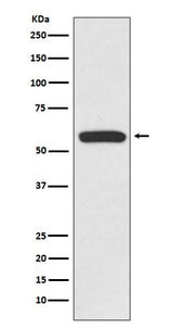 Anti-IRF6 Rabbit Monoclonal Antibody Boster Bio