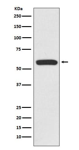 Anti-IRF6 Rabbit Monoclonal Antibody Boster Bio