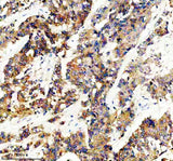 Anti-GLB1 Rabbit Monoclonal Antibody Boster Bio
