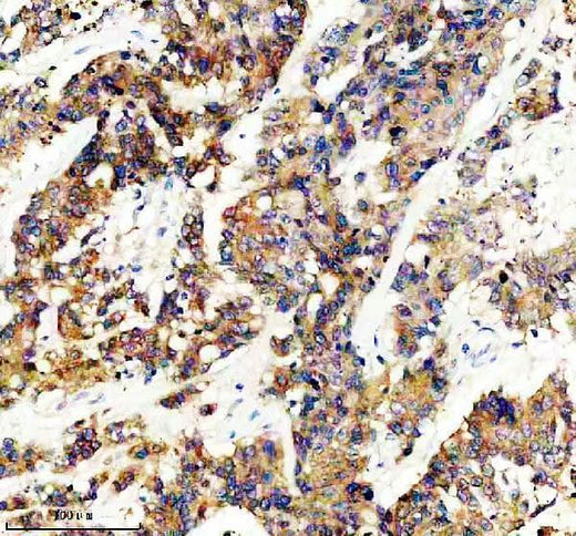 Anti-GLB1 Rabbit Monoclonal Antibody Boster Bio